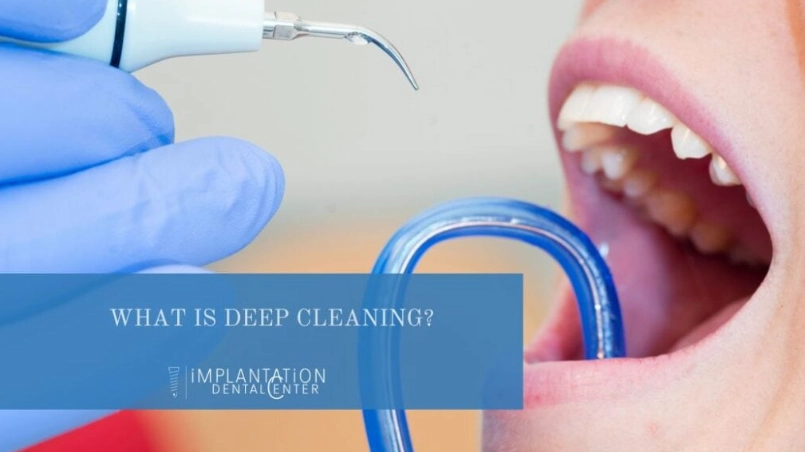 Why Are Dentists Pushing Deep Cleanings? The Honest Truth Behind the Treatment