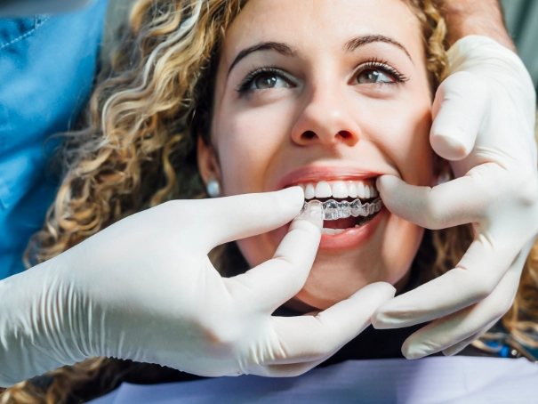 How Fast Do Teeth Shift Without a Retainer? A Complete Timeline