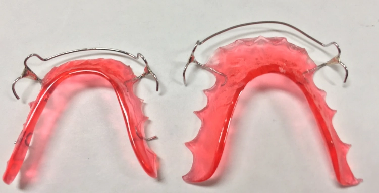 How Often Should You Replace Your Teeth Retainer? A Complete Guide