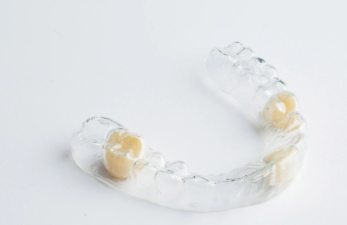 retainer replacement schedule retainer replacement schedule