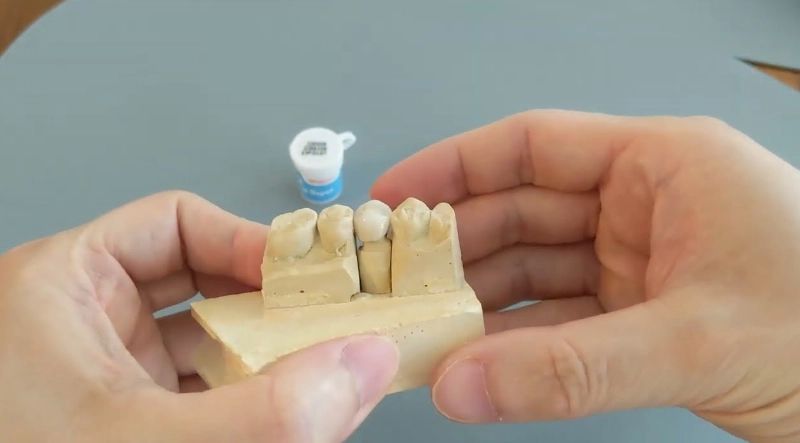 dental crown cement dental crown cement