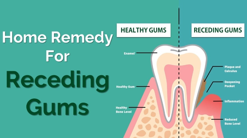 gum recession treatment gum recession treatment