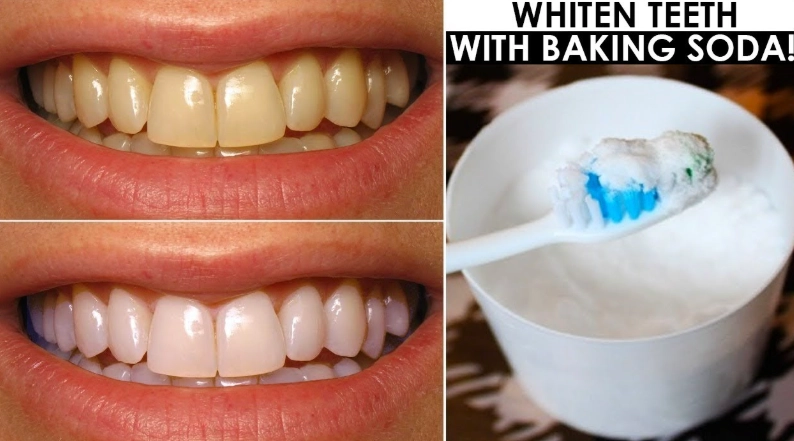 whiten teeth in 5 minutes