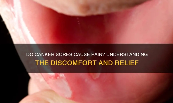 canker sores causes canker sores causes