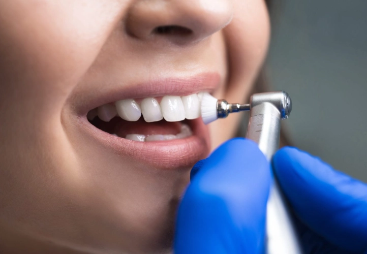 disadvantages of deep cleaning