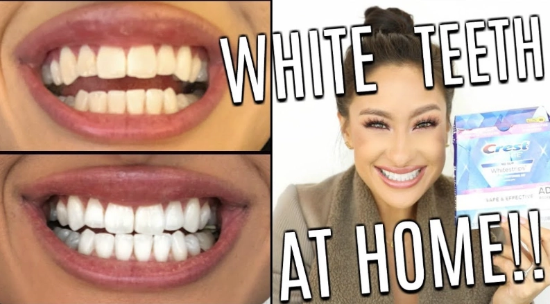Crest 3D White strips review
