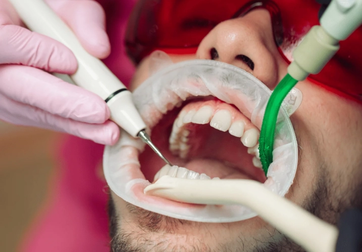 professional cleaning cons