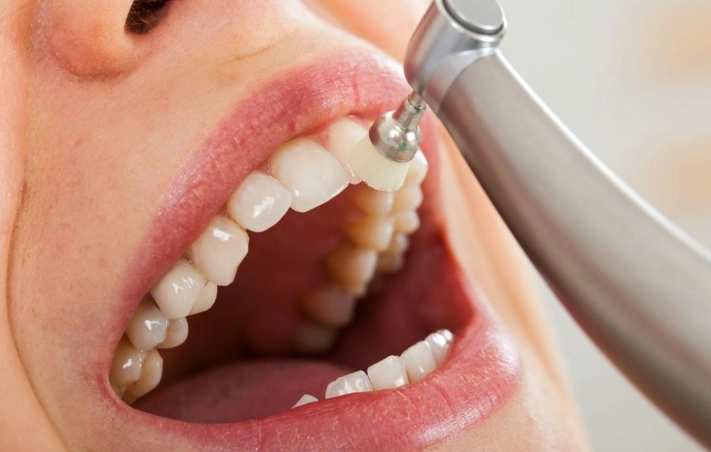 How Long Does a Deep Dental Cleaning Take? A Complete Time Guide