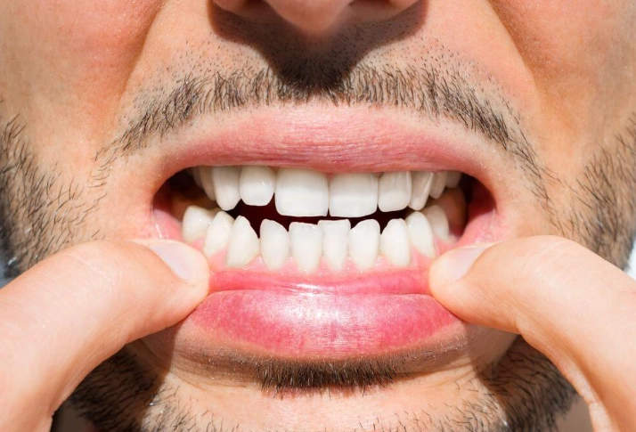 worst foods for teeth