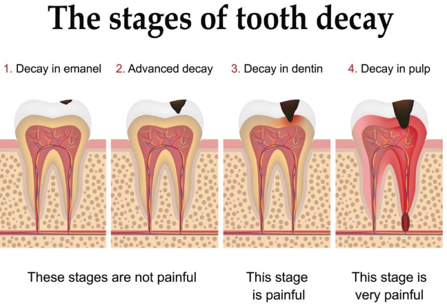 cavity pain symptoms cavity pain symptoms