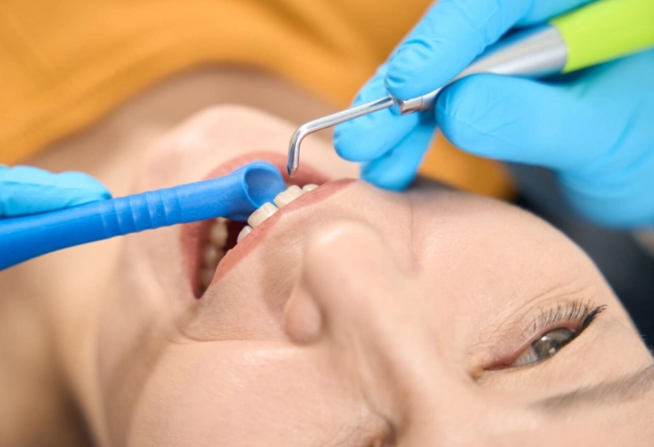 what to expect after deep cleaning