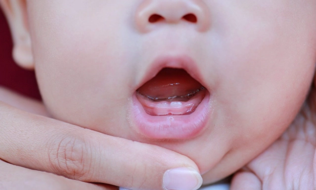 teething pain worst months