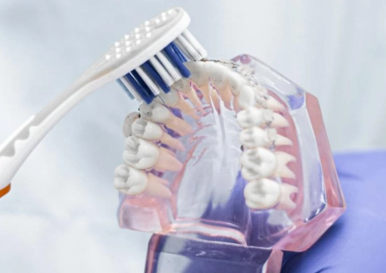 dental deep cleaning