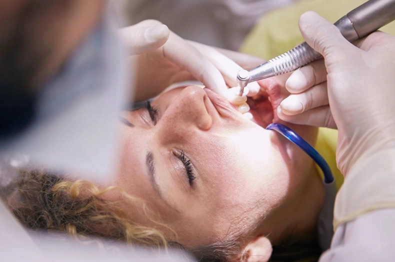 scaling and root planing