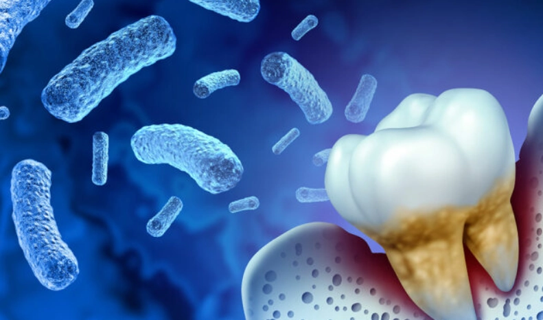 how to treat P. gingivalis