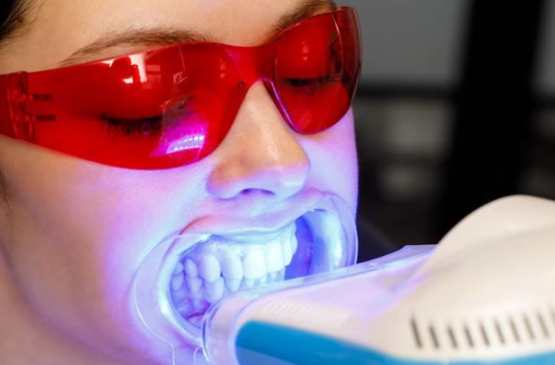 teeth whitening products reviews teeth whitening products reviews