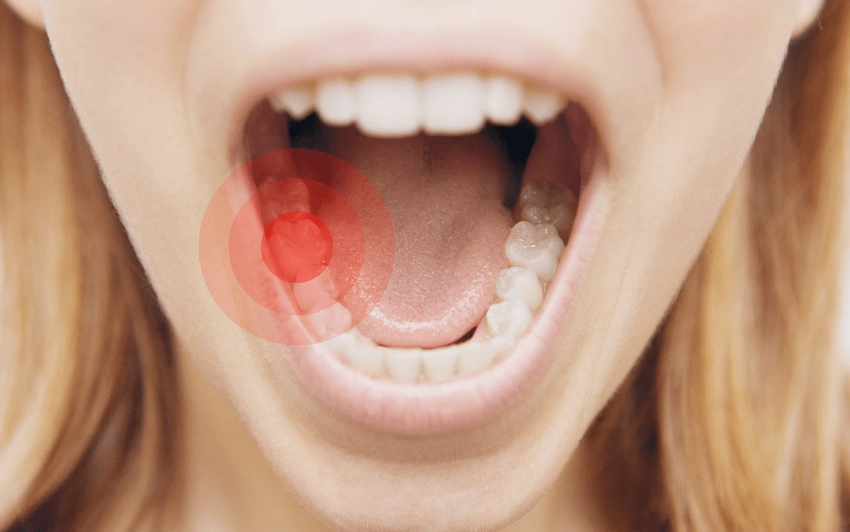 salt water rinse for toothache