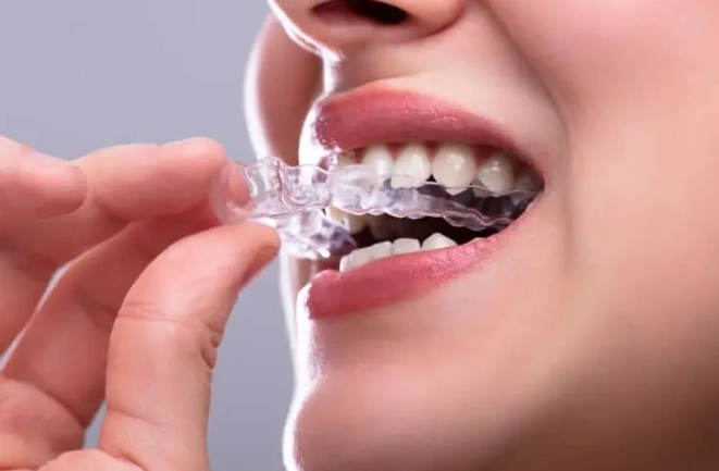 Soft Night Guard for Teeth Grinding: Your Ultimate Guide to Comfort & Protection