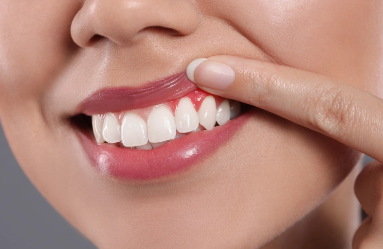 deep cleaning teeth recovery time