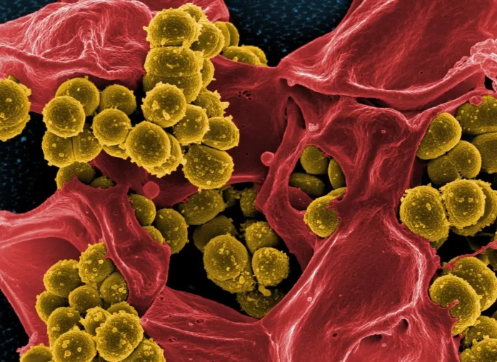 transmission of e-gingivalis