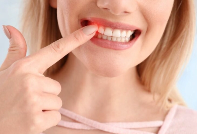 gum recession treatment kids gum recession treatment kids