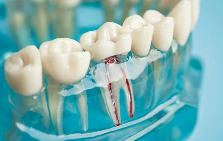 torus palatinus torus palatinus