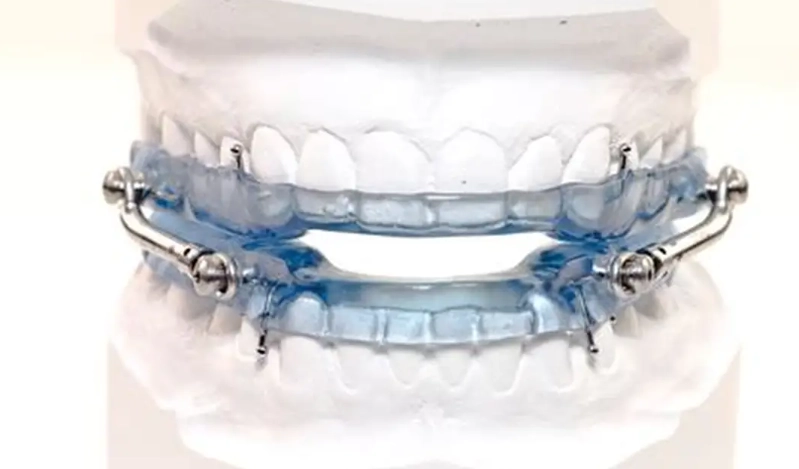 best mouthpiece for sleep apnea