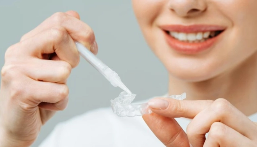 fast teeth whitening gel fast teeth whitening gel