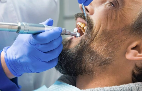 Dental Deep Cleaning Reviews: Real Patient Stories, Costs & What to Expect