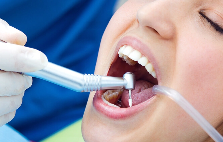 dental deep cleaning reviews dental deep cleaning reviews