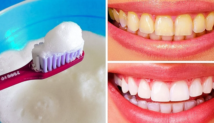 Fast Teeth Whitening at Home: Safe, Effective Methods & What Really Works