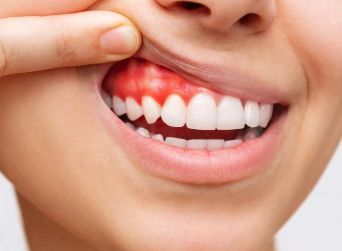 night guard problems