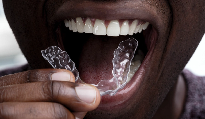 Best Night Guard for Teeth Grinding: Ultimate Buyer's Guide & Top Picks