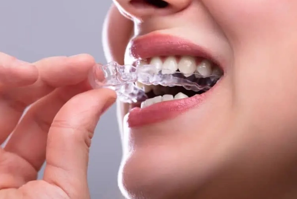 bruxism guard side effects