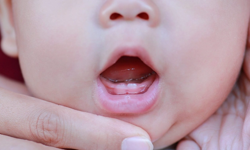 How to Know If Baby Is in Pain from Teething: Complete Parent's Guide