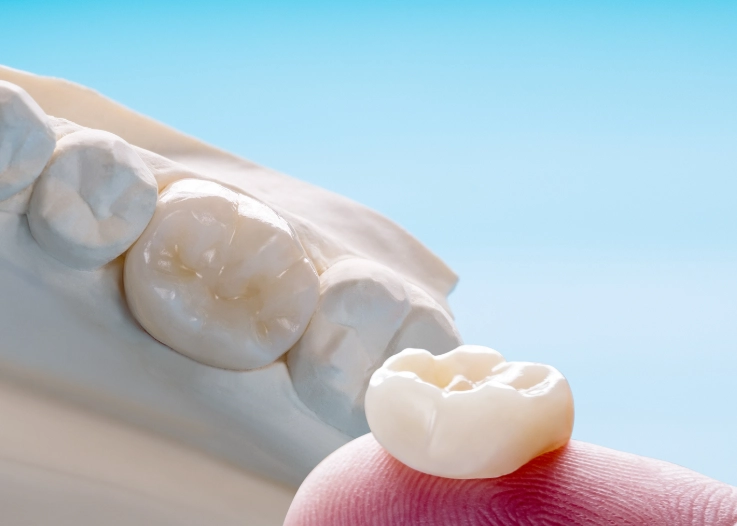 cost to scale a business cost to scale a business