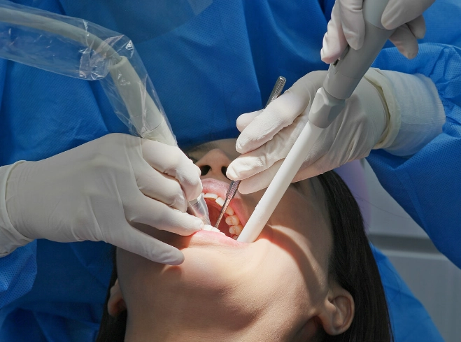 best sensitive teeth whitening strips best sensitive teeth whitening strips