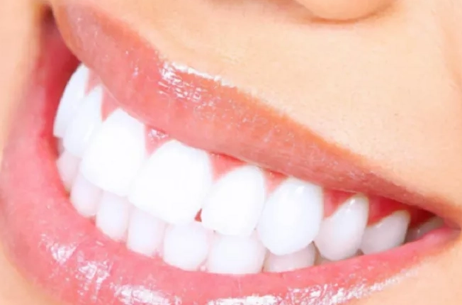 best teeth whitening products