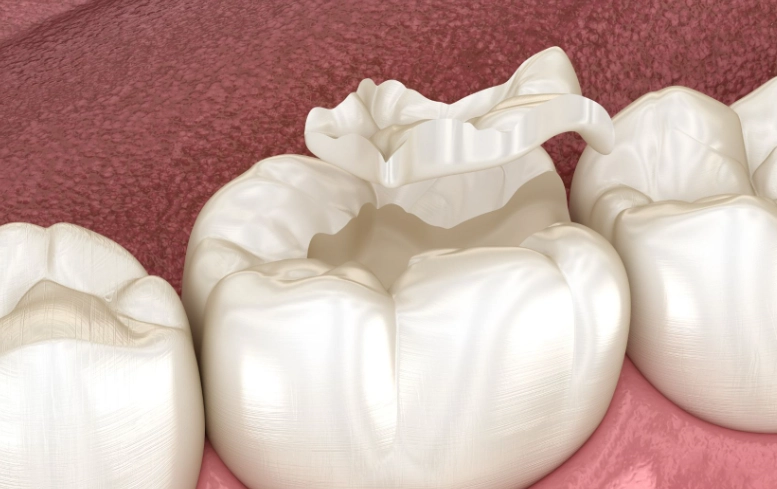 Tooth Filling Guide: Types, Costs, Pain, and Longevity Explained