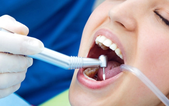 deep teeth cleaning
