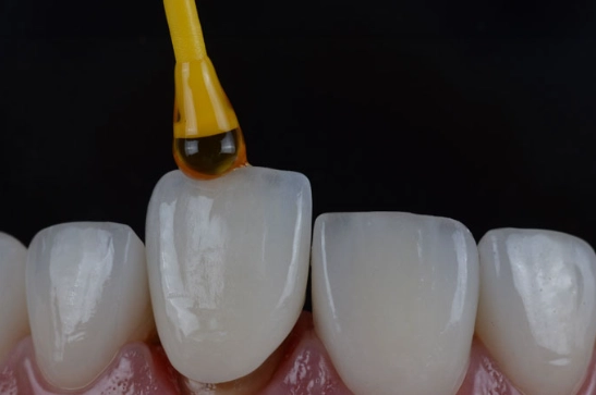 how to glue a crown back on how to glue a crown back on