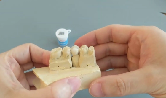 how to glue a crown back on how to glue a crown back on