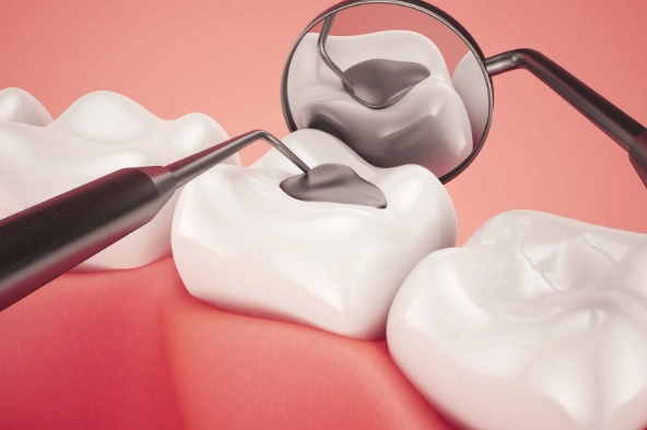 Tooth Filing: A Complete Guide to Types, Procedure, and Costs