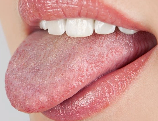how to get rid of oral thrush