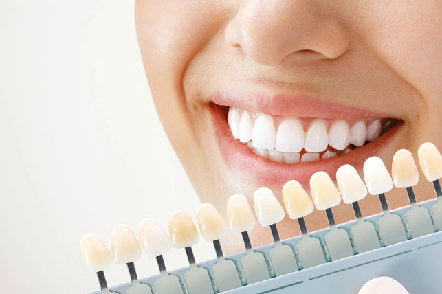 The Safest Teeth Whitening Options: A Dentist's Guide to a Bright Smile