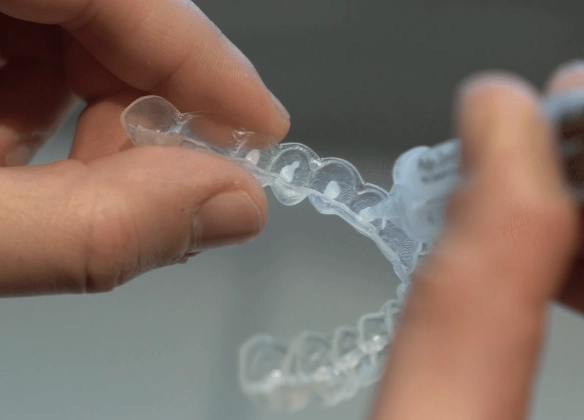 Whitening Teeth at Home: A Safe and Effective Guide