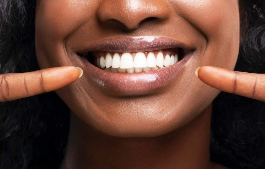 safe teeth whitening