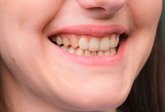 nutrition for healthy gums nutrition for healthy gums