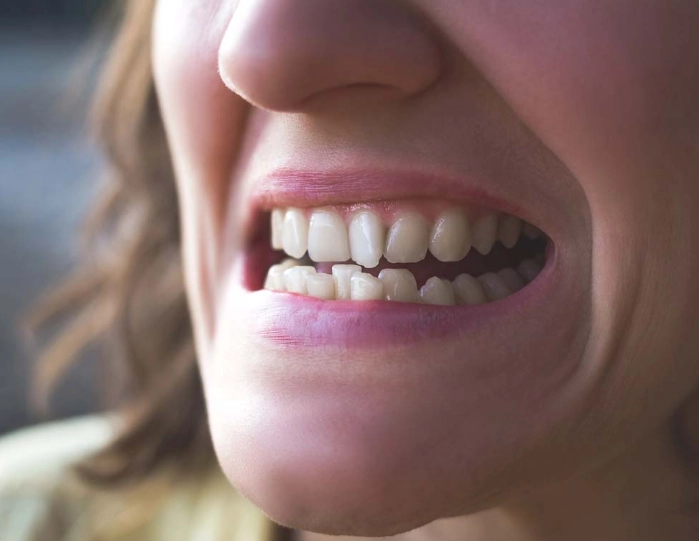 teeth straightening options