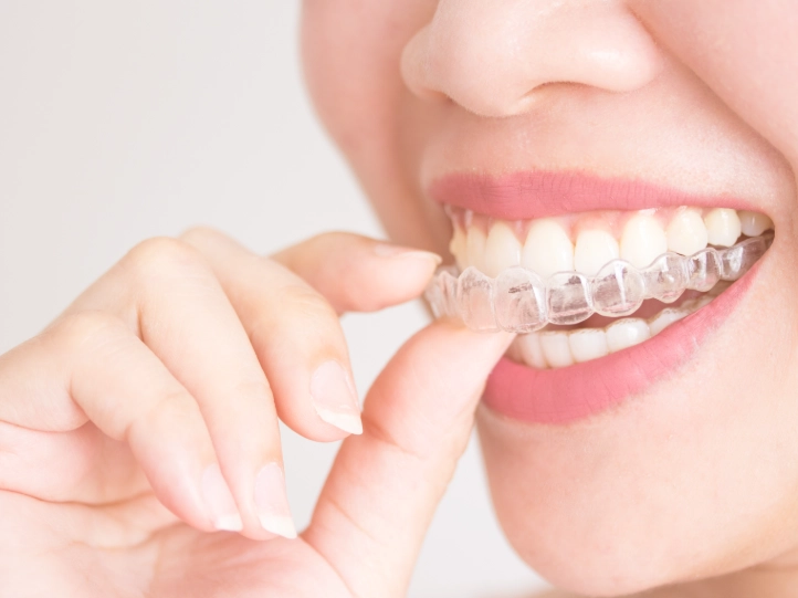 invisalign vs clear aligners